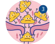 constipation_4_3_faecespushed