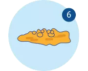 constipation_7_6_normalbowel3